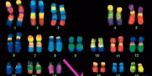 BEAT THE TRAIN FOR DOWN SYNDROME 2025 \ud83d\udc9c