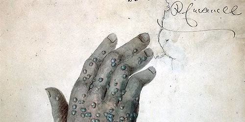 Smallpox in Early Boston: A free walking tour!