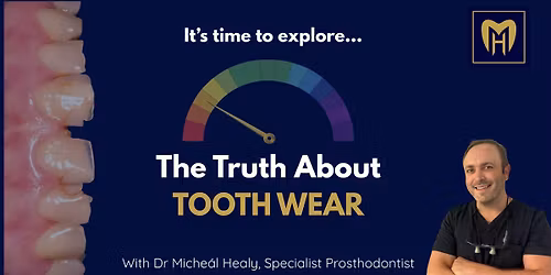The Truth About Tooth Wear