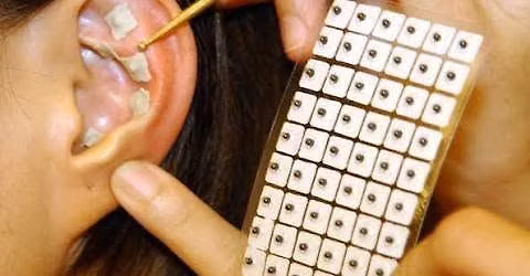 Auricular Acupressure Ear Seed Therapy Training with Dr. Brian Grosam
