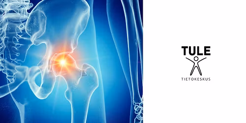 Kipe\u00e4n lonkan liikeharjoitteet -toiminnallinen tietoisku