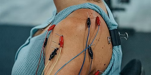 DN-Advanced: Advanced Dry Needling