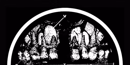 VOTIV\/\/RANK\/\/TEAR AWAY\/\/HARD FACTS\/\/