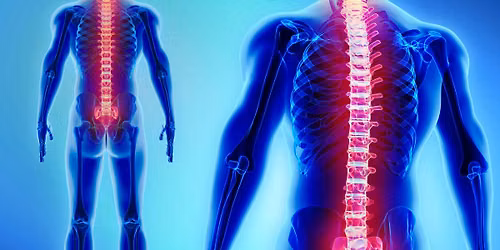 On-Demand: Metastatic Spinal Cord Compression Study Day