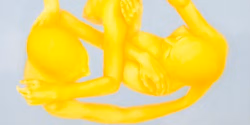 Seniorsk\u00fd program: s\u00fa\u010dasn\u00e1 ma\u013eba \u2013 Dorota Sadovsk\u00e1