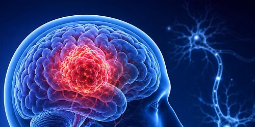 World Brain Tumour Day - Free consultation