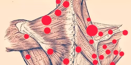Course #5: Trigger Points\/ROM\/MET
