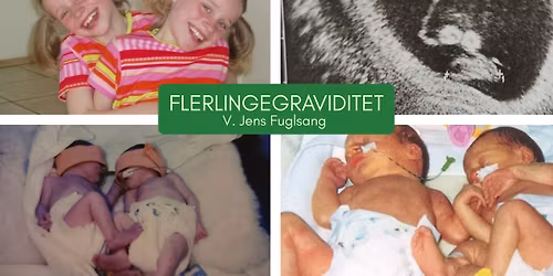 Foredrag: Flerlingegraviditeter v. Jens Fuglsang\ud83d\udc9a