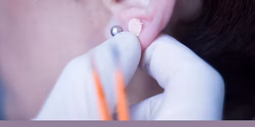 TCM: Auricular Theory