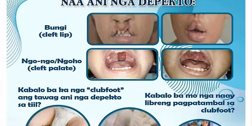 Clubfoot screening and mission
