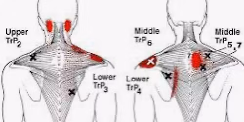 Anatomy Review, Pain Referral Pattern CEU