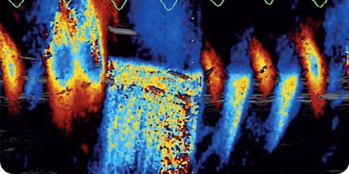 Echo Compact \/ Advanced 2026