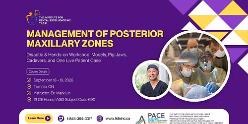 MANAGEMENT OF POSTERIOR MAXILLARY ZONES