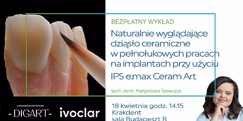 Naturalnie wygl\u0105daj\u0105ce dzi\u0105s\u0142o ceramiczne w pe\u0142no\u0142ukowych pracach na implantach- IPS e.max Ceram Art