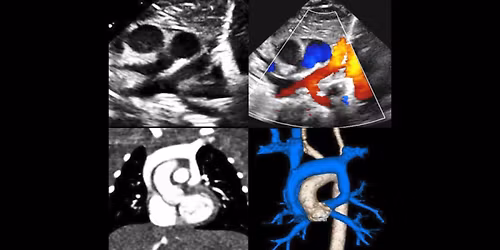 Annual Morphology and Imaging in Congenital Heart Disease: The Key to Diagnosis and Management