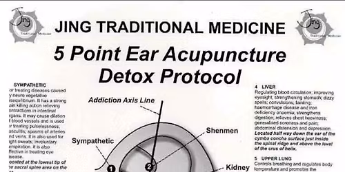 Free ear acupuncture session