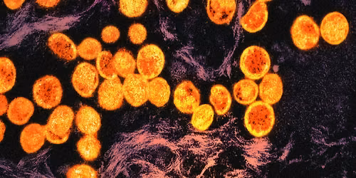 Mathematical Oncology: Could We Cure Cancer with Calculus?